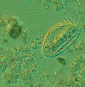 Live protozoa: Suitable live food for larval fish and shrimp?