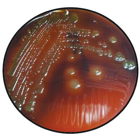 Article image for Field diagnostic tools for pathogenic vibrios