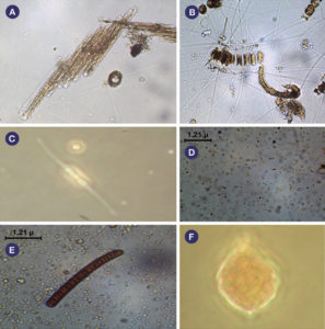 Plankton communities in shrimp monoculture, integrated biofloc system