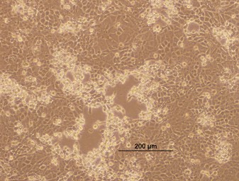 A cytopathic effect (CPE) of tissue culture cells (CHSE-214). "This is what I look for in tissue culture, which indicates that P. sal is proliferating inside the cell and causing the circular swelling look that you see and plaque-like zones of clearance where cells are killed," Makrinos said. 