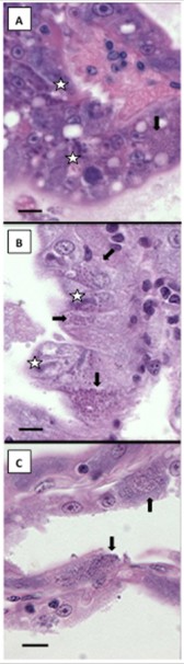图1：对虾肠孢虫病(EHP)组织病理学显现在感染的对虾上。（A&B）南美白对虾的肝脏胰组织，（C）蓝对虾。箭头代表成熟的孢子；星星代表原形体阶段。（比例=25μm.） 