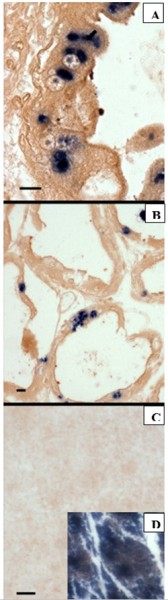Fig 4. In situ hybridization of the consecutive section with a digoxigen-labeled EHP probe. The presence of dark blue precipitates indicates the presence of EHP (A) in situ hybridization in Penaeus vannamei (from Vietnam) with EHP probe; (B) P. stylirostris (Brunei); (C) P. monodon showing cotton shrimp disease (Madagascar), insert photo: ISH with a Perezia penaei probe. Scale bars = 25 μm. 