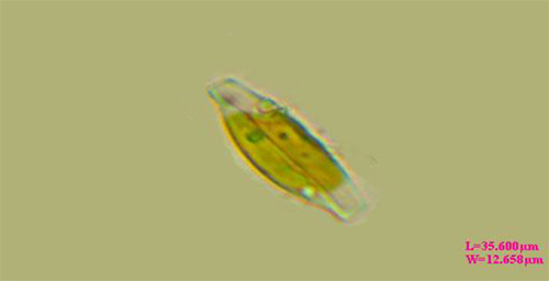 Cell size of Amphora gamma Karsten.
