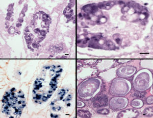 Camarones que muestran WFS presentan EHP y SHPN; EHP + SHPN=WFS.