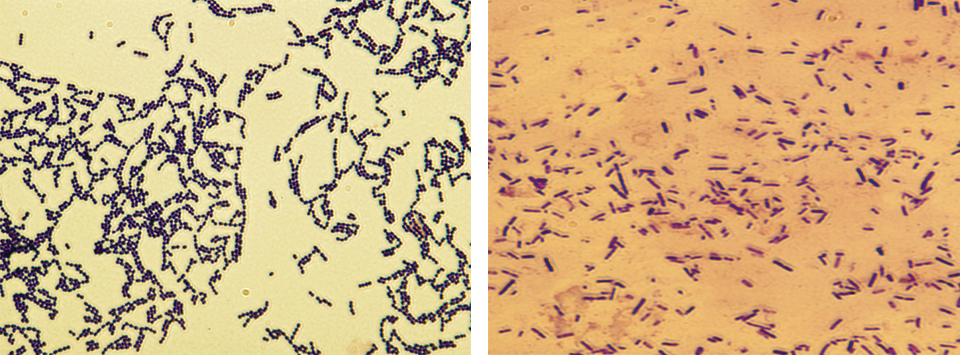 Article image for Developing live bacterial vaccines by selecting resistance to antibacterials