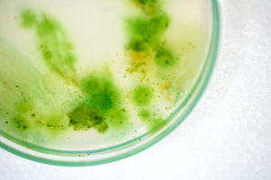 laboratorio al estomago