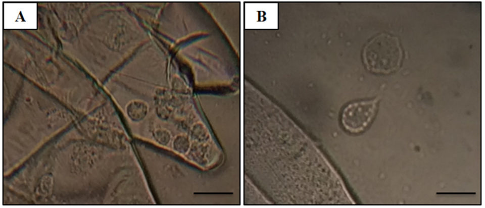 Fig. 1: Samples obtained from wet mount squashes of the gills. (A) Variations in morphology of amoeba and (B) individual free-living amoeba. Scale bars = 20 µm.