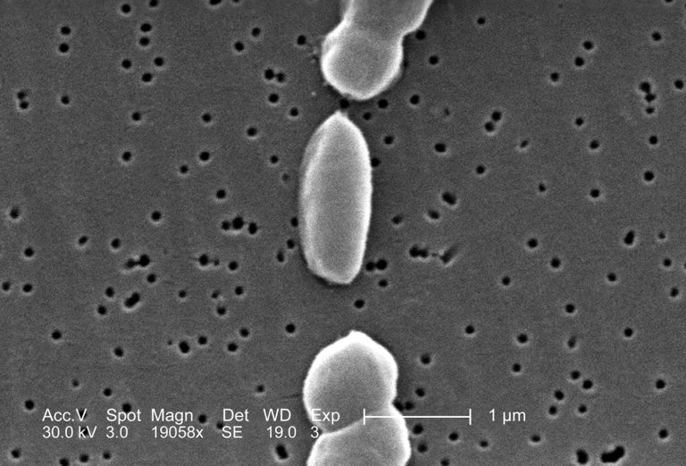 Article image for A rapid, sensitive RPA assay for detection of Vibrio parahaemolyticus in seafood