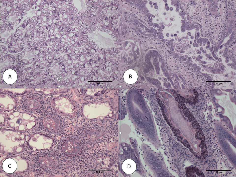 Fig.2: Histología de H&amp;E (hematoxilina Mayer-Bennet y eosina-floxina) de camarones SPF infectados con VPAHPND a 24 hpi-6 dpi: (A) <em>P. vannamei</em> del tanque de control negativo (B) Fase aguda de la infección por AHPND (C ) fase terminal de la infección AHPND (D) Fase crónica de la infección AHPND. Barras de escala = 100μ. Las fotos B a D representan camarones de línea libres de patógenos específicos.