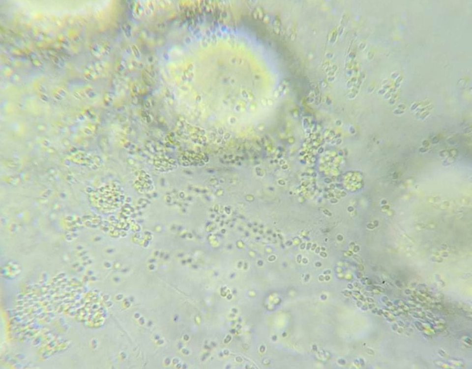 Article image for Evaluación in vitro de dos biocidas comerciales sobre la tasa de extrusión de esporas de EHP