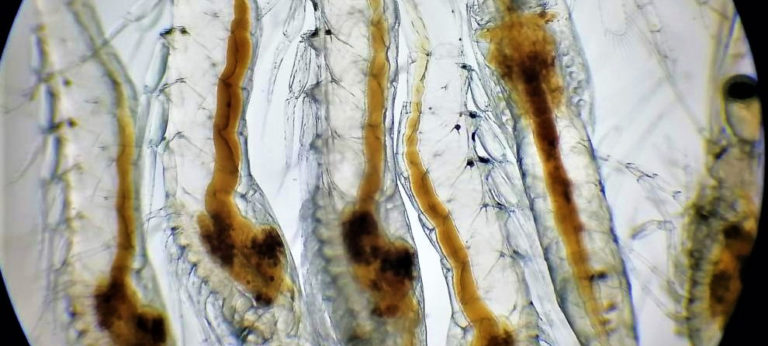 Vibrio metabólicamente