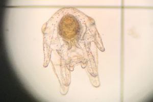 Green sea urchin larvae as seen under a microscope.