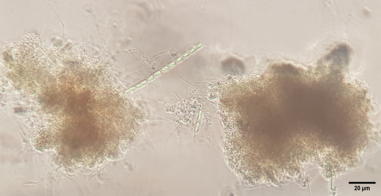 Article image for Effect of aeration on the development of the microbial community in shrimp biofloc technology systems