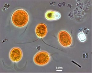 Potential for production of highly valuable PUFAs from microalgae