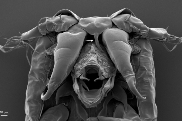 sea lice