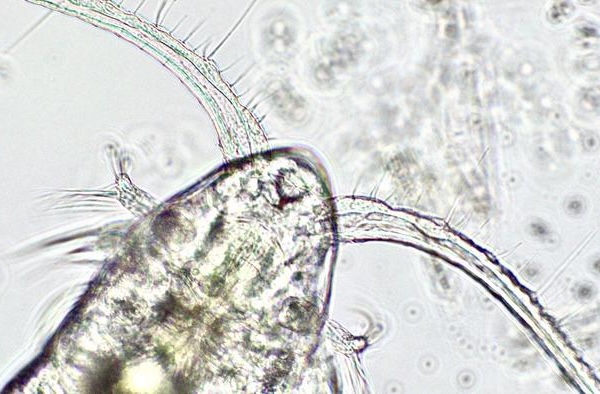 harmful algal blooms